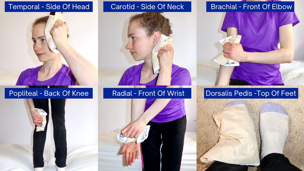 pulse points to place ice packs on to keep cool for pots heat intolerance